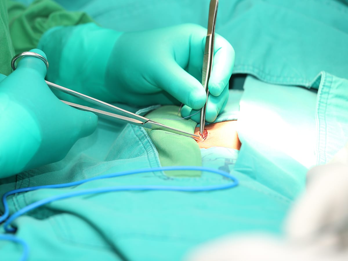 Hernia Repair Surgery  Medical Weight Loss & General Surgeon Port